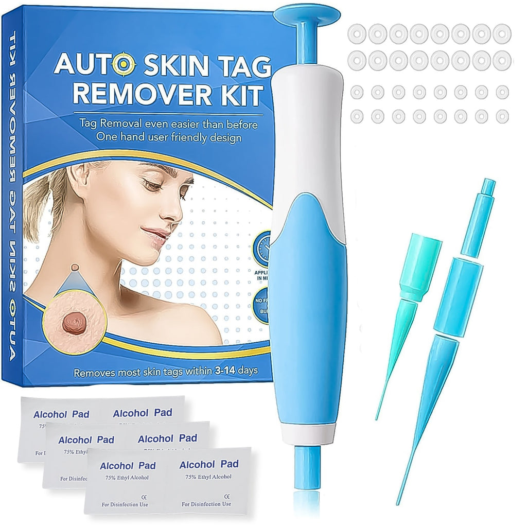 Blue and white skin tag remover kit with alcohol pads and two sizes of bands on a white background. – view 3