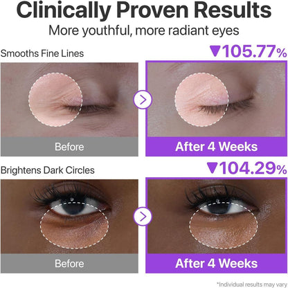 Volumetox Eye Cream 100 gm